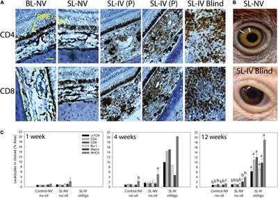 Immune Activities in Choroids of Visually Impaired Smyth Chickens With Autoimmune Vitiligo